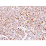 Immunohistochemistry - GnT-III antibody from Signalway Antibody (22062) - Antibodies.com