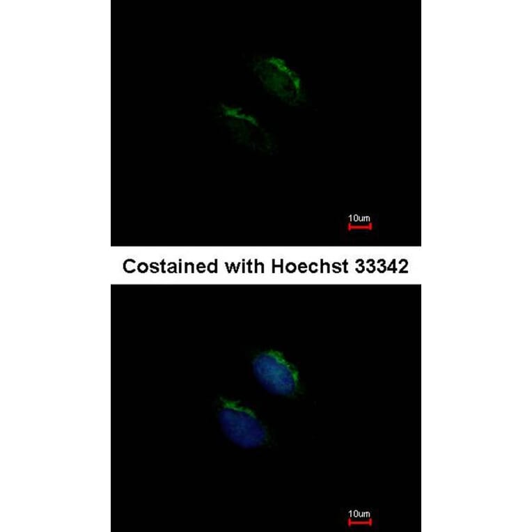 Immunofluorescence - GnT-III antibody from Signalway Antibody (22062) - Antibodies.com
