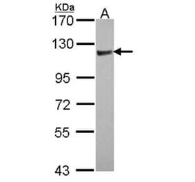 Rho GAP4 antibody from Signalway Antibody (22189) - Antibodies.com