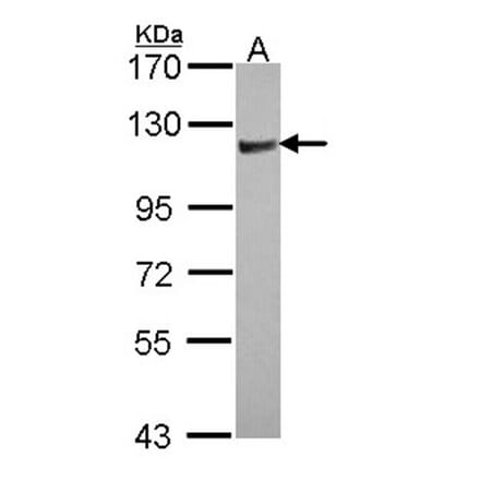 Rho GAP4 antibody from Signalway Antibody (22189) - Antibodies.com