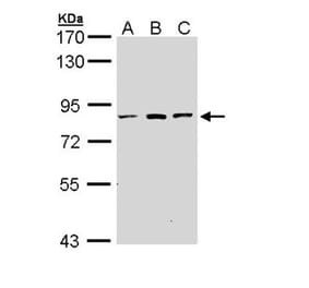 ATP6V0A2 antibody from Signalway Antibody (22666) - Antibodies.com