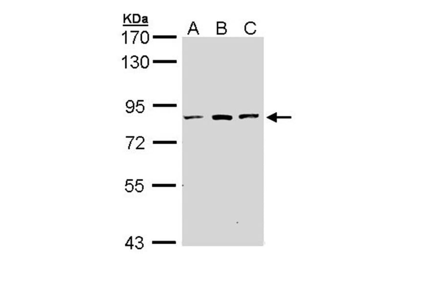 ATP6V0A2 antibody from Signalway Antibody (22666) - Antibodies.com
