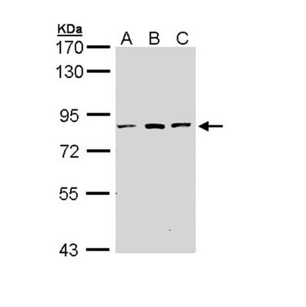 ATP6V0A2 antibody from Signalway Antibody (22666) - Antibodies.com