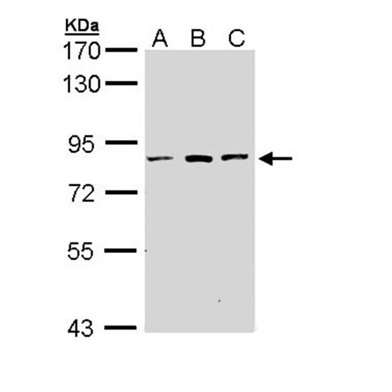 ATP6V0A2 antibody from Signalway Antibody (22666) - Antibodies.com