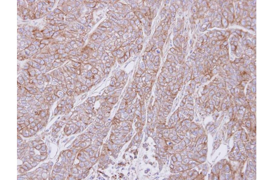 Immunohistochemistry - ATP6V0A2 antibody from Signalway Antibody (22666) - Antibodies.com