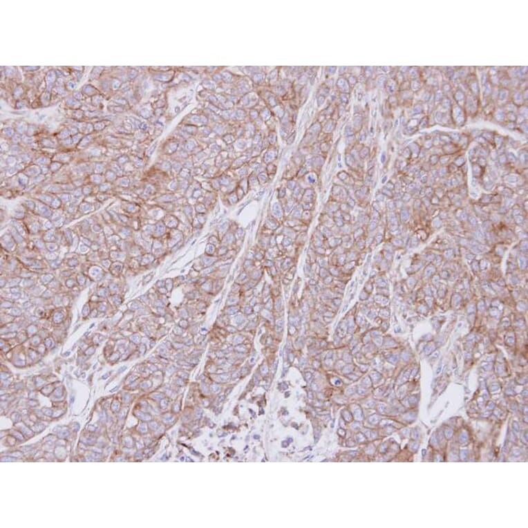 Immunohistochemistry - ATP6V0A2 antibody from Signalway Antibody (22666) - Antibodies.com