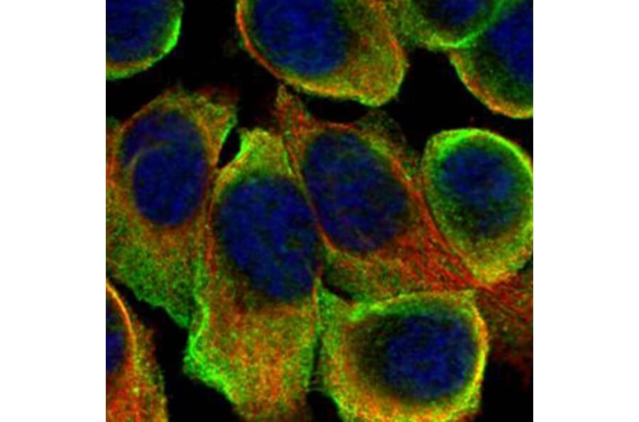 ATP6V0A2 antibody from Signalway Antibody (22666) - Antibodies.com