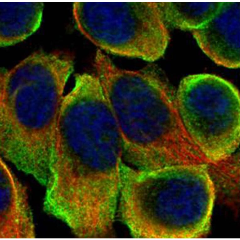 ATP6V0A2 antibody from Signalway Antibody (22666) - Antibodies.com