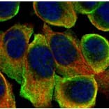 ATP6V0A2 antibody from Signalway Antibody (22666) - Antibodies.com