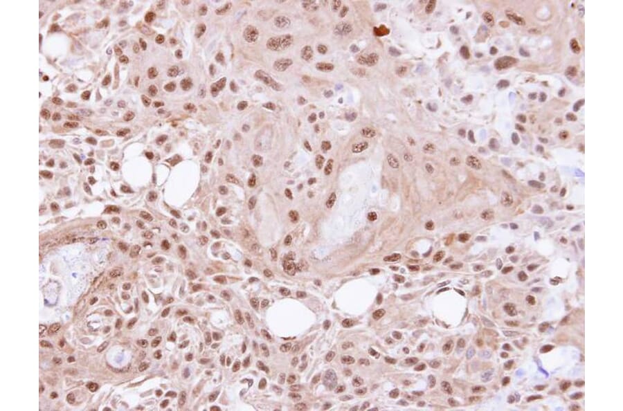 Immunohistochemistry - VCP (p97) antibody from Signalway Antibody (22687) - Antibodies.com