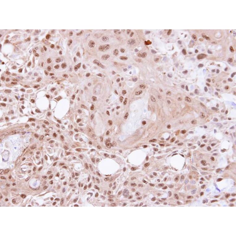 Immunohistochemistry - VCP (p97) antibody from Signalway Antibody (22687) - Antibodies.com