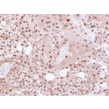 Immunohistochemistry - VCP (p97) antibody from Signalway Antibody (22687) - Antibodies.com