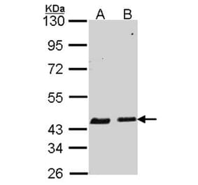 SERPINB6 antibody from Signalway Antibody (22756) - Antibodies.com