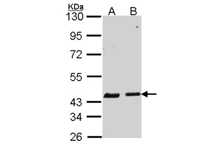 SERPINB6 antibody from Signalway Antibody (22756) - Antibodies.com