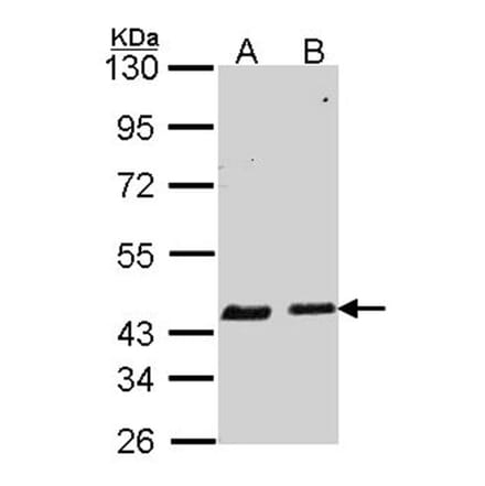 SERPINB6 antibody from Signalway Antibody (22756) - Antibodies.com