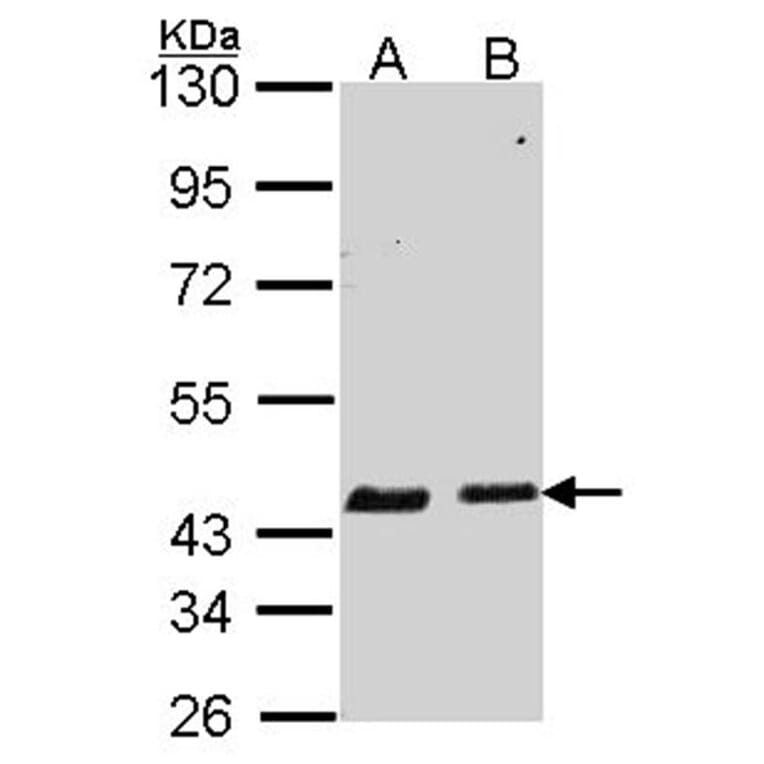 SERPINB6 antibody from Signalway Antibody (22756) - Antibodies.com