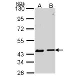 SERPINB6 antibody from Signalway Antibody (22756) - Antibodies.com