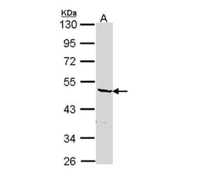 hnRNP F antibody from Signalway Antibody (22842) - Antibodies.com