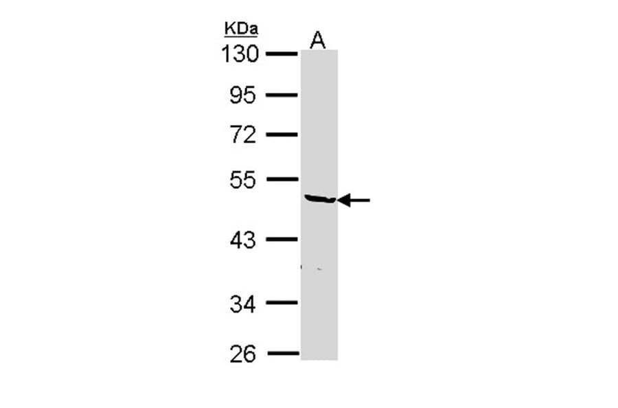 hnRNP F antibody from Signalway Antibody (22842) - Antibodies.com