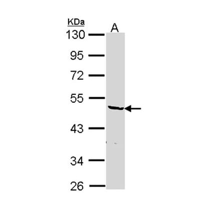 hnRNP F antibody from Signalway Antibody (22842) - Antibodies.com