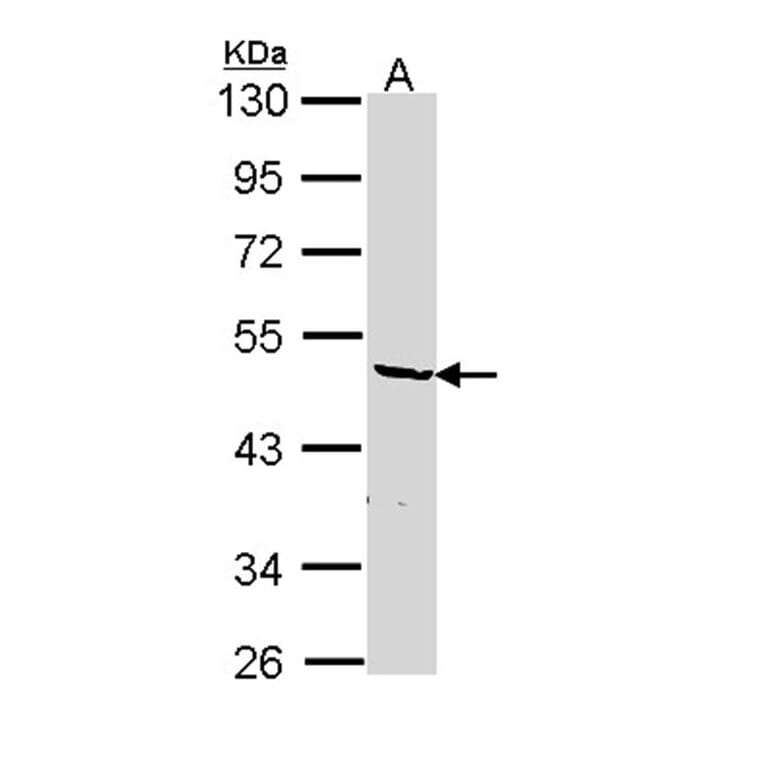 hnRNP F antibody from Signalway Antibody (22842) - Antibodies.com