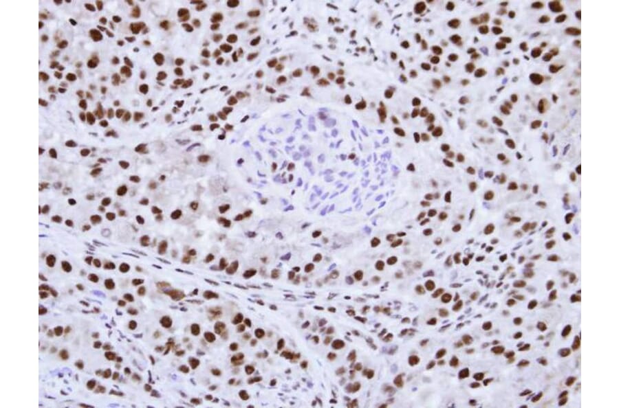 Immunohistochemistry - hnRNP F antibody from Signalway Antibody (22842) - Antibodies.com