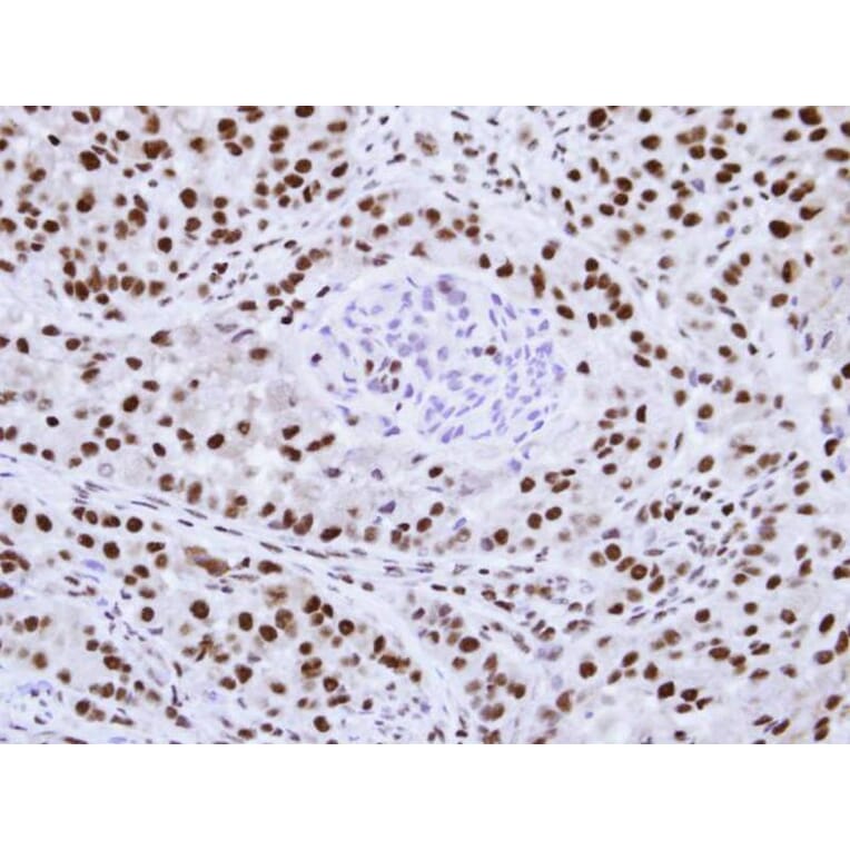 Immunohistochemistry - hnRNP F antibody from Signalway Antibody (22842) - Antibodies.com