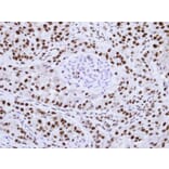 Immunohistochemistry - hnRNP F antibody from Signalway Antibody (22842) - Antibodies.com
