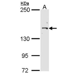 Cullin-7 antibody from Signalway Antibody (22865) - Antibodies.com