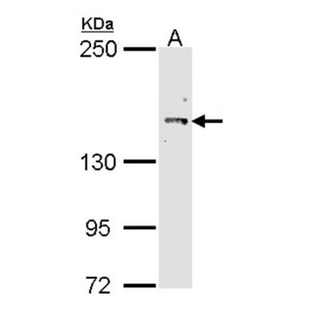 Cullin-7 antibody from Signalway Antibody (22865) - Antibodies.com