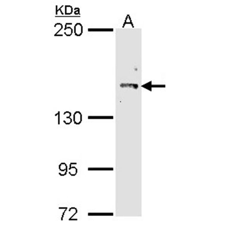Cullin-7 antibody from Signalway Antibody (22865) - Antibodies.com