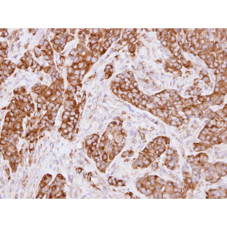 Immunohistochemistry - LRP (MVP) antibody from Signalway Antibody (22901) - Antibodies.com