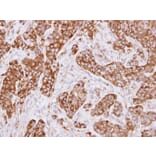Immunohistochemistry - LRP (MVP) antibody from Signalway Antibody (22901) - Antibodies.com