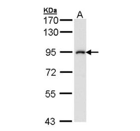 IKK beta antibody from Signalway Antibody (22942) - Antibodies.com