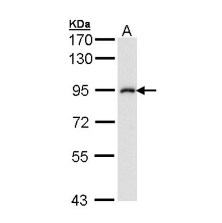 IKK beta antibody from Signalway Antibody (22942) - Antibodies.com