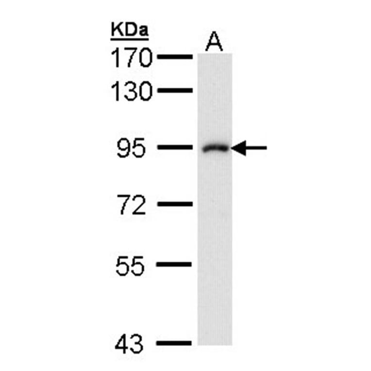 IKK beta antibody from Signalway Antibody (22942) - Antibodies.com