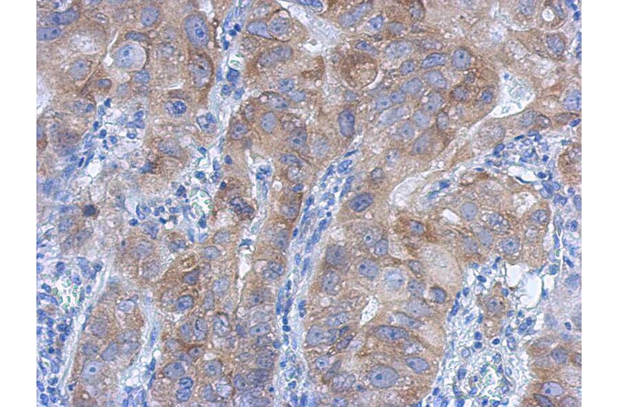 Immunohistochemistry - IKK beta antibody from Signalway Antibody (22942) - Antibodies.com