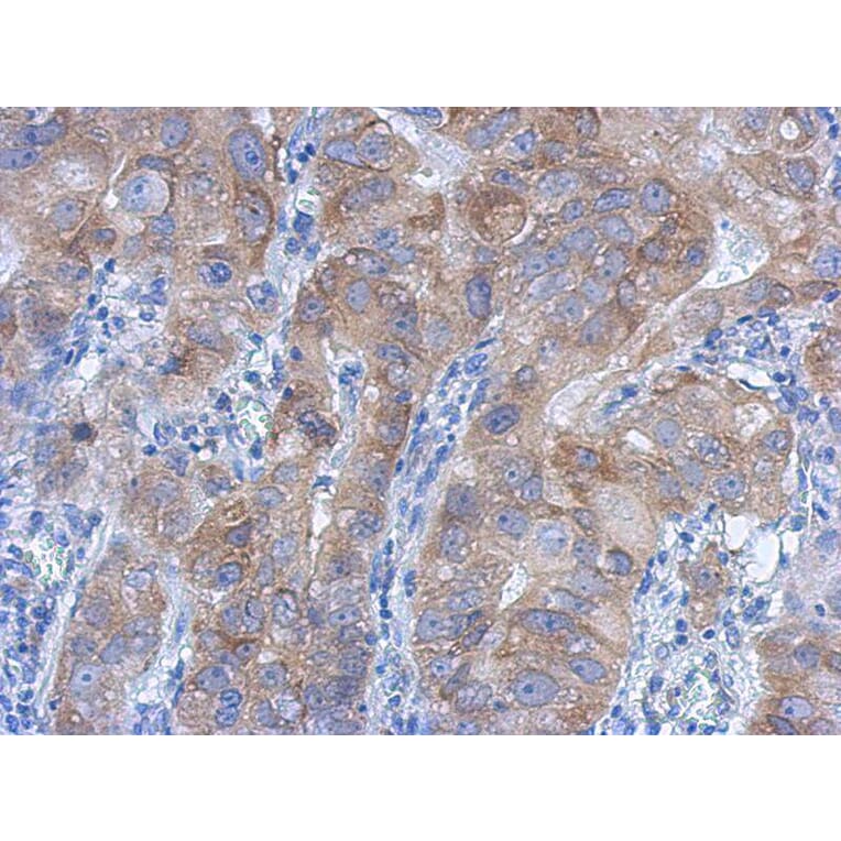 Immunohistochemistry - IKK beta antibody from Signalway Antibody (22942) - Antibodies.com
