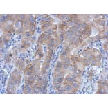 Immunohistochemistry - IKK beta antibody from Signalway Antibody (22942) - Antibodies.com