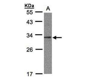 C20orf11 antibody from Signalway Antibody (23135) - Antibodies.com