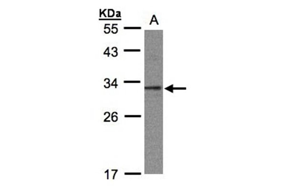 C20orf11 antibody from Signalway Antibody (23135) - Antibodies.com