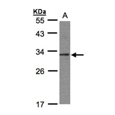 C20orf11 antibody from Signalway Antibody (23135) - Antibodies.com