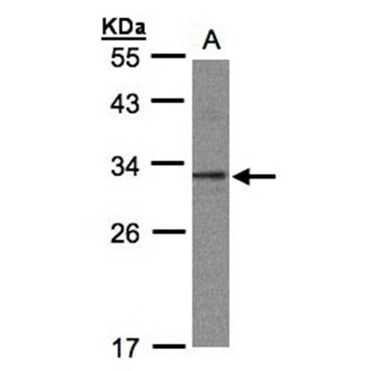 C20orf11 antibody from Signalway Antibody (23135) - Antibodies.com