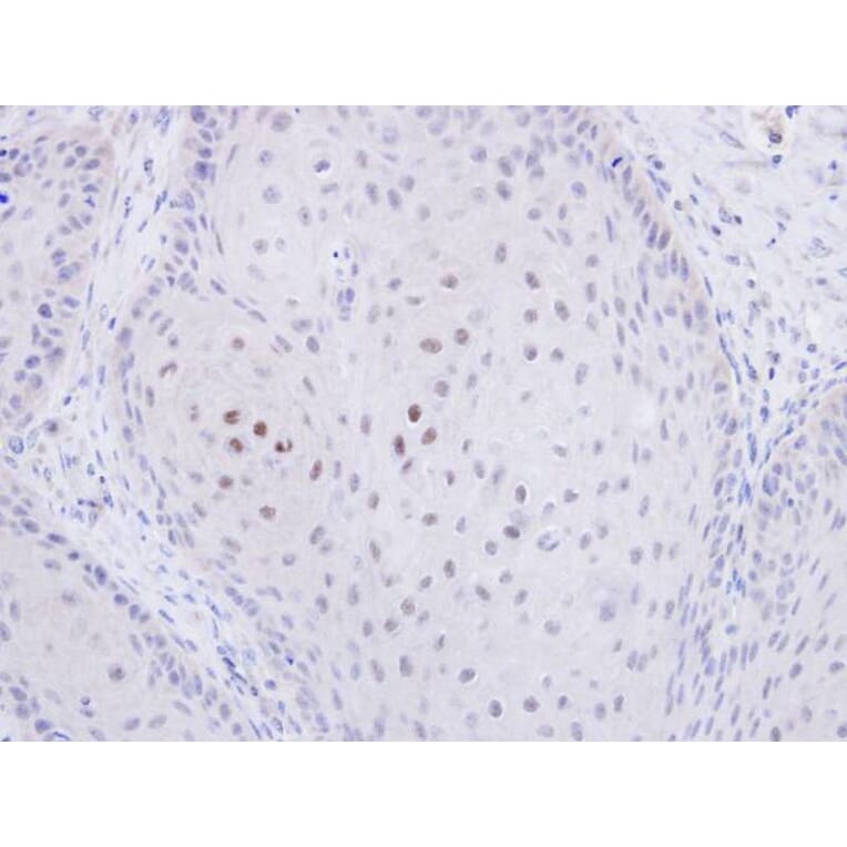 Immunohistochemistry - C20orf11 antibody from Signalway Antibody (23135) - Antibodies.com