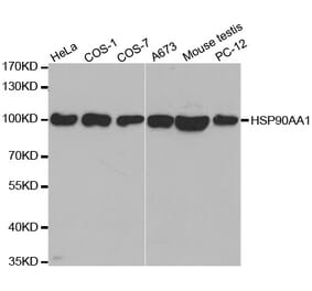 Western blot - HSP90AA1 Antibody from Signalway Antibody (32072) - Antibodies.com