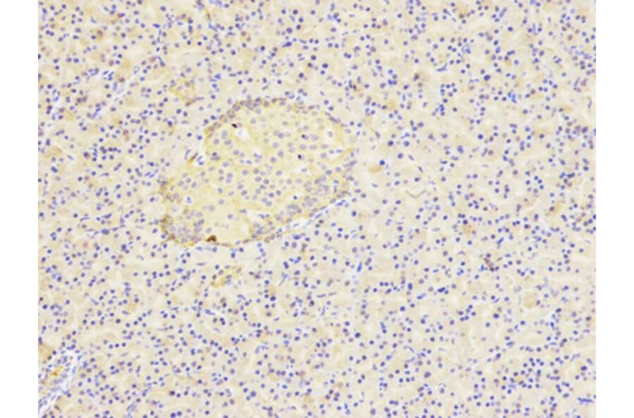 Immunohistochemistry - HSP90AB1 Antibody from Signalway Antibody (32151) - Antibodies.com