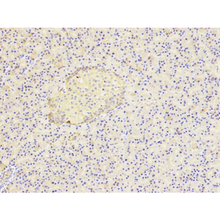 Immunohistochemistry - HSP90AB1 Antibody from Signalway Antibody (32151) - Antibodies.com