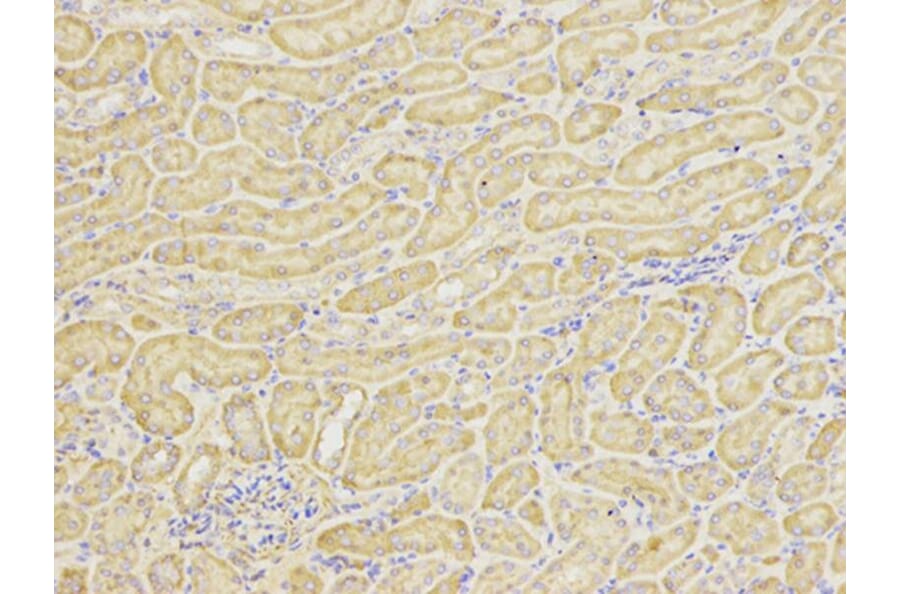 Immunohistochemistry - HSP90AB1 Antibody from Signalway Antibody (32151) - Antibodies.com