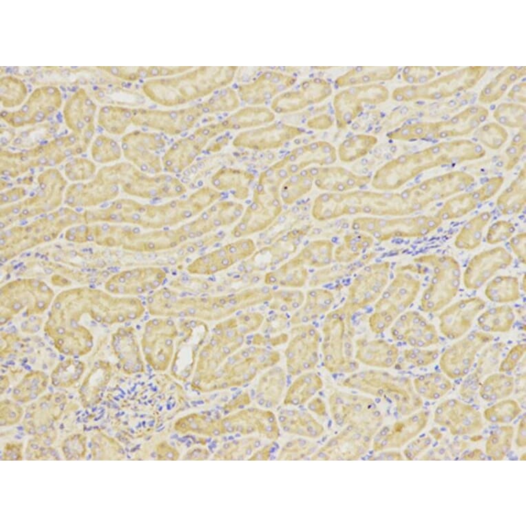 Immunohistochemistry - HSP90AB1 Antibody from Signalway Antibody (32151) - Antibodies.com