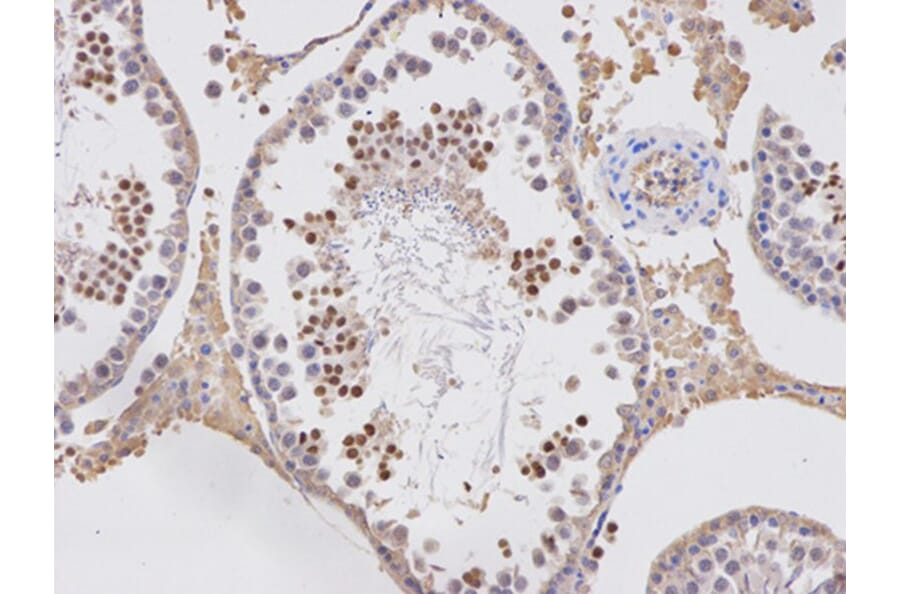 Immunohistochemistry - APOBEC3G Antibody from Signalway Antibody (32283) - Antibodies.com